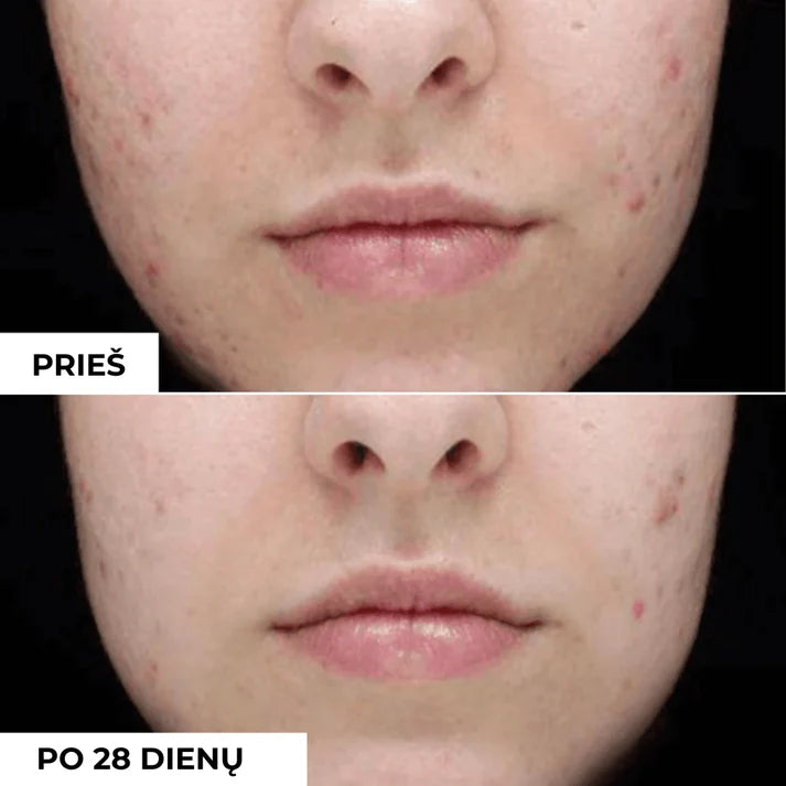 Dermeden Purifying Cleansing Gel rezultatai
